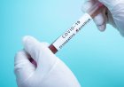 How Can I Test for COVID-19?